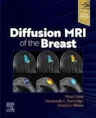 DIFFUSION MRI OF THE BREAST, E-Book | MRI انتشار پستان، کتاب الکترونیکی